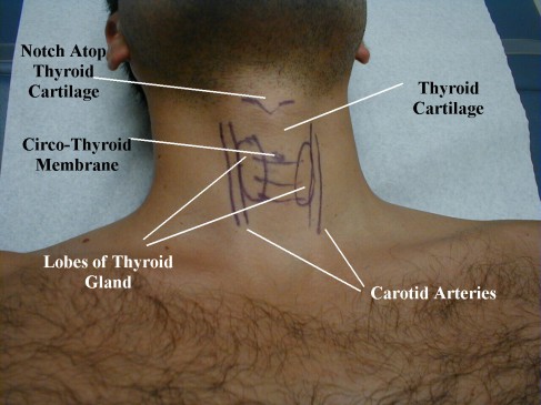 AYUSH doctor will Anatomy learn from five Dead bodies