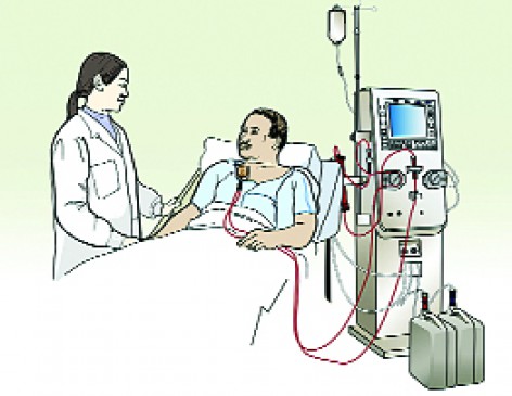 Dialysis will now be in 500 rupees