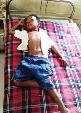 One student child died in road accident and five children serious injured