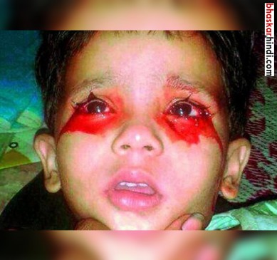 This baby crying tears of blood, the help of PM Modi