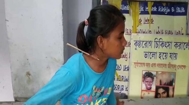 arrow pierces neck of 14 year old archer at sai centre