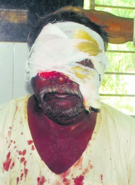 Dreaded wolf attacked on 8 people of a village