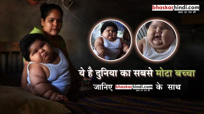 10 माह की उम्र में 30 किलो वजन, इतना मोटा है ये बच्चा