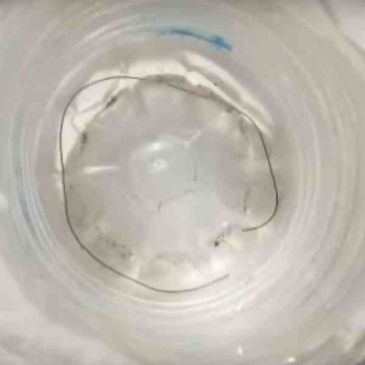 सावधान ! नाखून से बाॅडी में प्रवेश करने की कोशिश करता है ये धागा सांप