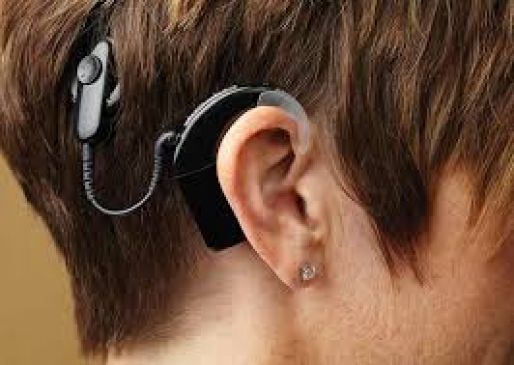 600 deaf children will get benefit of cochlear implant surgery