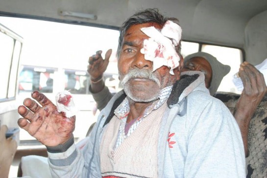 Eye patients bus accident in satna district, four people serious injured