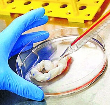 Advantages of Preserving Newborn Babys Umbilical cord Advantages of Preserving Newborn Babys Umbilical cord