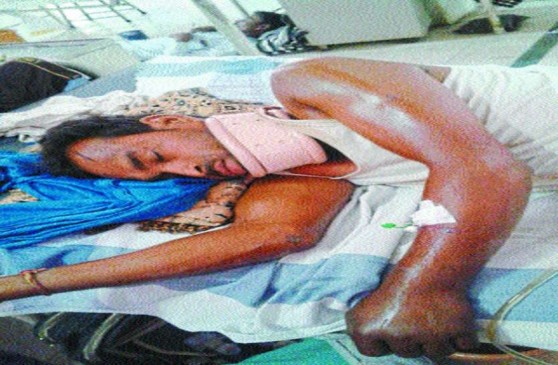 Bhola will be treated now on government expenditure