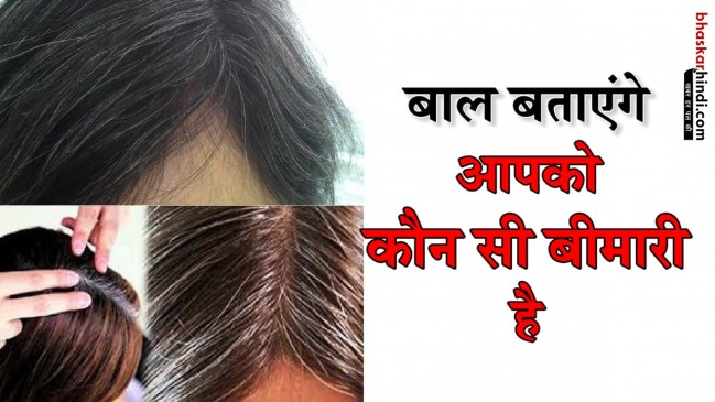 सेहत के राज खोलते हैं आपके बाल, जानिए कैसे?