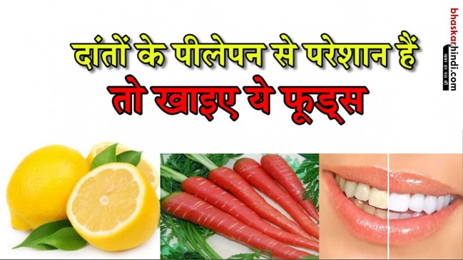 ये फूड्स लाएंगे आपके दांतों में चमक