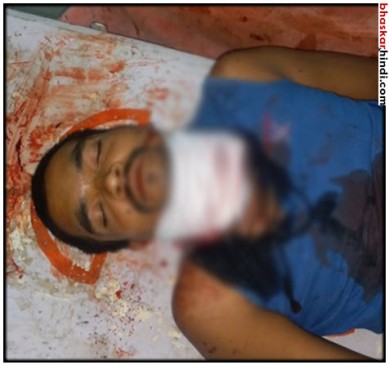 Patients suffering from throat cut due to ignorance of doctors