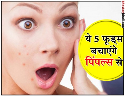 ये 5 फूड्स खाने से कभी नहीं होंगे पिंपल्स, स्किन रहेगी साफ और चमकदार ये 5 फूड्स खाने से कभी नहीं होंगे पिंपल्स, स्किन रहेगी साफ और चमकदार