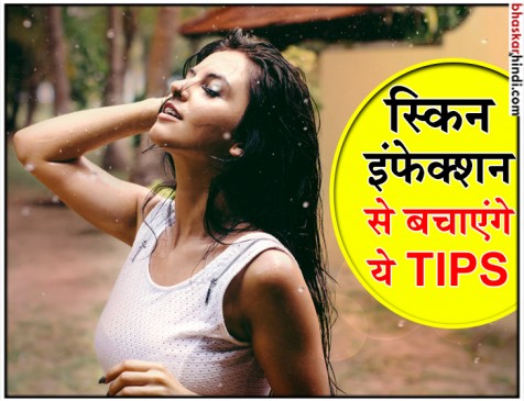 मानसून में स्किन इंफेक्शन से बचाएंगे ये उपाय, एक बार जरूर आजमाएं मानसून में स्किन इंफेक्शन से बचाएंगे ये उपाय, एक बार जरूर आजमाएं