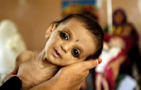 Till June, 1181 children have been found to be malnourished.