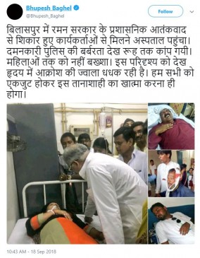 छत्तीसगढ़: कांग्रेस भवन में घुसी पुलिस, कार्यकर्ताओं को घसीटकर निकाला बाहर, डंडों से पीटा छत्तीसगढ़: कांग्रेस भवन में घुसी पुलिस, कार्यकर्ताओं को घसीटकर निकाला बाहर, डंडों से पीटा