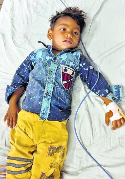 the four year old child swallowed the battery, taken out by surgery