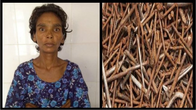 Oh no! एकु फोजिया बीमारी से पीड़ित महिला के पेट से निकली सेफ्टी पिन, चूड़ियां