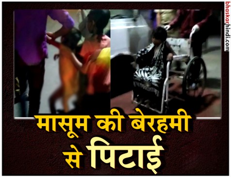 कार चालक ने फुग्गे बेच रहे बच्चे को पीटा, गुप्तांग पर लगी चोट
