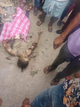 Girl set on fire by man for rejecting his love proposal vagdevi college