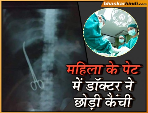 ऑपरेशन के दौरान महिला के पेट में छोड़ी कैंची, सर्जन टीम के खिलाफ मामला दर्ज