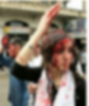 Fake News: खून से लथपथ महिला की तस्वीर कश्मीर की बताकर वायरल