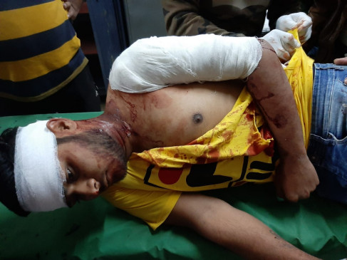 Bloody conflict between two groups, a young man stabbed with knives, condition critical