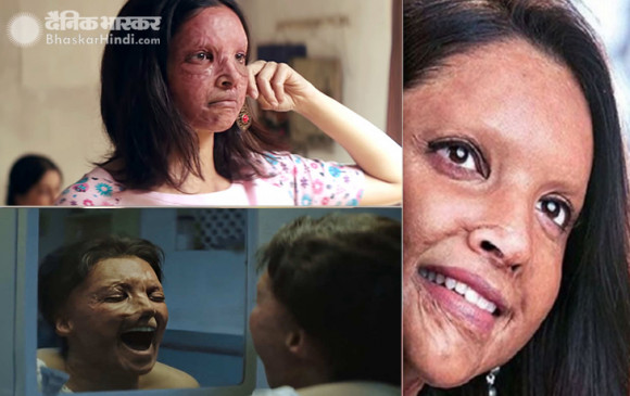 Chhapaak Review: दीपिका के किरदार को देखकर कांप जाएंगी आपकी रुह, एक बार जरुर देखें फिल्म