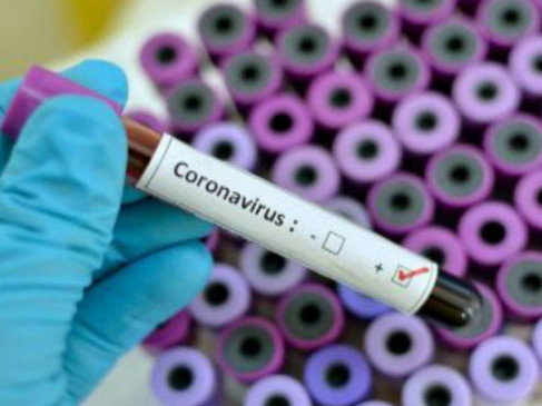Now more emphasis on home quarantine than sample testing, only then symptoms will be investigated Now more emphasis on home quarantine than sample testing, only then symptoms will be investigated