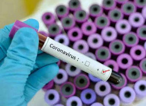 Covid-19 Test: अब ऑनलाइन बुकिंग कर किया जा सकेगा कोरोना का टेस्ट, जानें पूरी प्रोसेस Covid-19 Test: अब ऑनलाइन बुकिंग कर किया जा सकेगा कोरोना का टेस्ट, जानें पूरी प्रोसेस