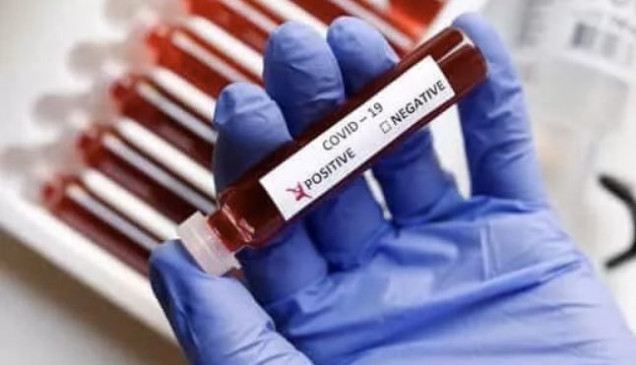 Coronavirus: कोविड-19 वायरस से लड़ने के लिए पायलट बाबा ने की 1.42 करोड़ की मदद