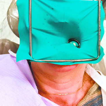 Corona Prevention: Use of Rubber Dam Technique in Dental, May Increase Cost Corona Prevention: Use of Rubber Dam Technique in Dental, May Increase Cost