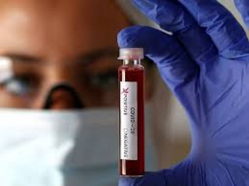 covid-19 rapidly rising figure in Vidarbha, one more death in Amravati, 6 infected including Akola health officer