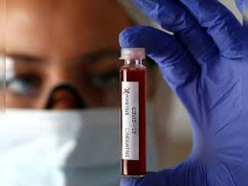 Rapidly growing corona in Nagpur, 150 new patients found again, 6 dead