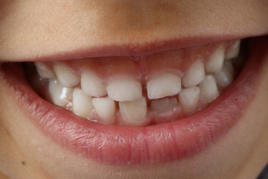 Send photos of bad teeth, Jamia will tell treatment on the phone