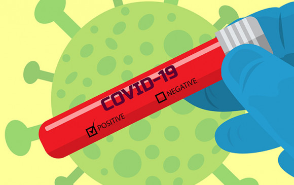 Corona in India: कोरोना ने तोड़े सारे रिकॉर्ड, 24 घंटे में 62 हजार से ज्यादा नए केस, मरीजों की संख्या 20 लाख के पार Corona in India: कोरोना ने तोड़े सारे रिकॉर्ड, 24 घंटे में 62 हजार से ज्यादा नए केस, मरीजों की संख्या 20 लाख के पार