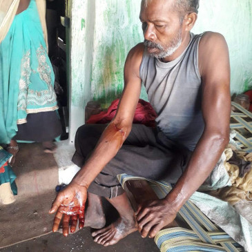Leopard attacked laborers coming from farm in Penchs buffer zone, three injured