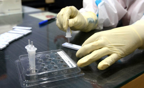 Sero-survey to begin in Uttar Pradesh from September 4