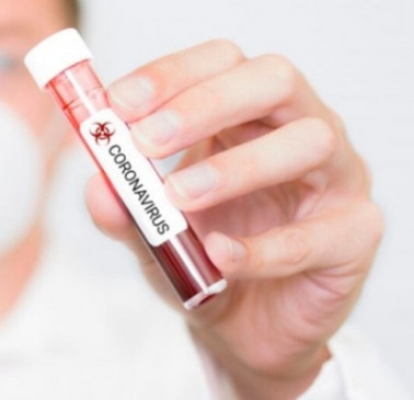 10 percent of the worlds population infected with Kovid-19: WHO