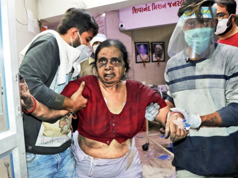  राजकोट के अस्पताल में लगी आग मामले में 3 सदस्यीय एसआईटी गठित 