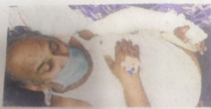 जिंदा मरीज को मृत बताकर बॉडी बैग में पैक कर रहे थे -जबलपुर के निजी अस्पताल का मामला