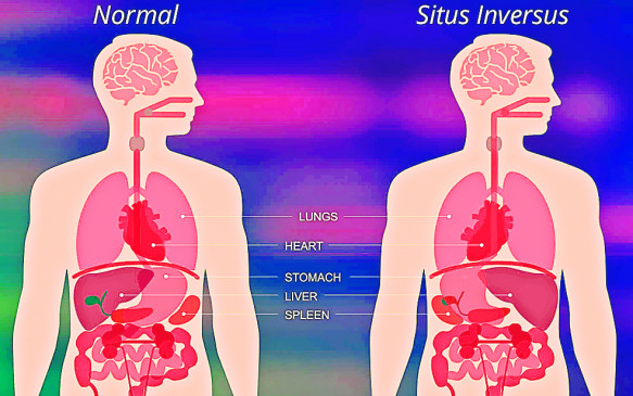 Internal organs in the youths body in the opposite direction, the army disqualified, the matter reached the High Court