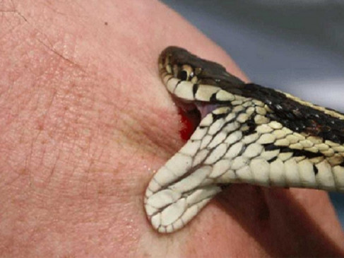 Snake bite victim did not get bed and injection