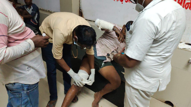 Stove kept on handcart burst, 6 injured including father and son