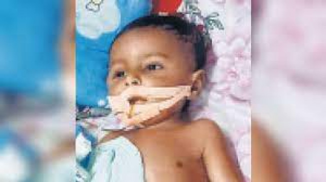Treatment of Spinal Muscular Atrophy can be done in Government Hospital in Mumbai