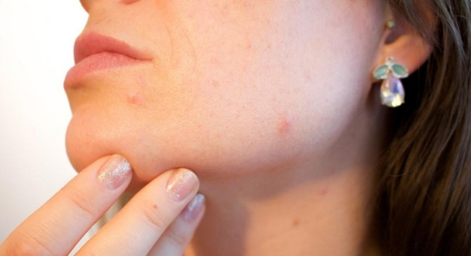 यूरोप में लगभग हर 2 में से 1 व्यक्ति को है त्वचा की समस्या
