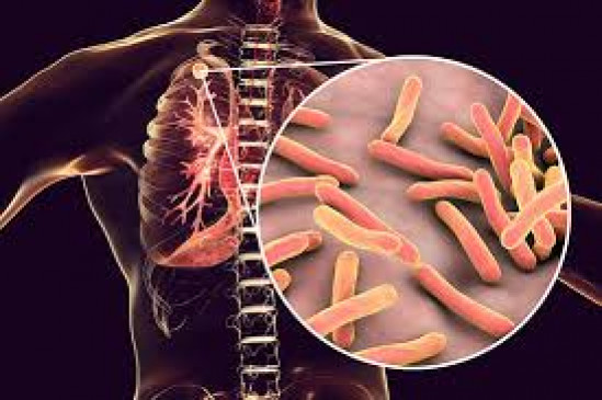 Formation of ten parties to make TB free district