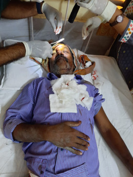 Accident in Sasti mine, 5 injured, 1 serious