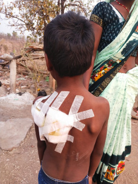 Bear attacked a six-year-old child who went in the open to defecate