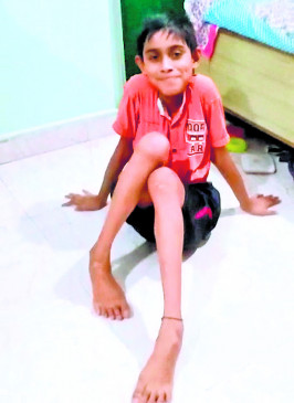 1 injection of Rs 16 crore, treatment can be done only after getting it
