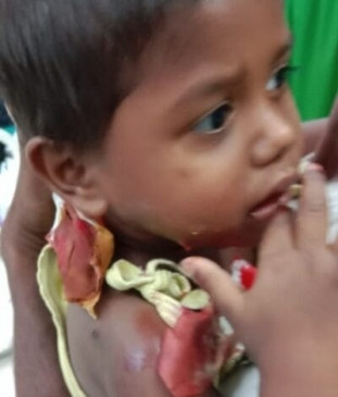 Every Day Mothers day - Woman clashed with a leopard to save childs life